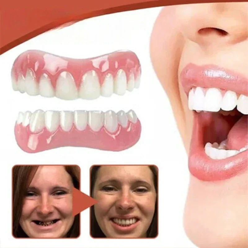 Snap on Veneers with Moldable Beads and Custom Fit Cosmetic False Teeth Kit - Image 5